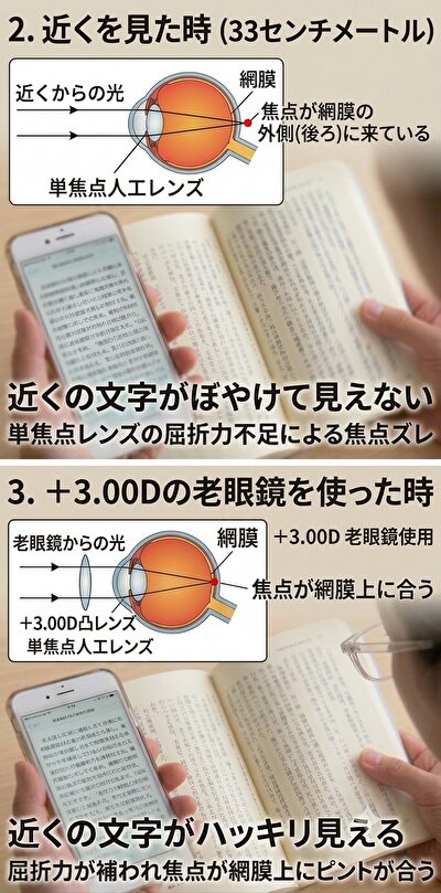 縮小人工レンズ近景ボケ ＋老眼